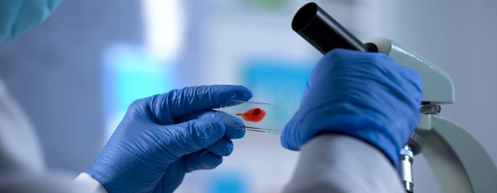 Der HIV-Forscher Prof. Dr. Hendrik Streeck ist davon überzeugt  dass es bei der Suche nach einem HIV-Impfstoff Erfolge geben wird. Foto: ©iStock.com/Motortion