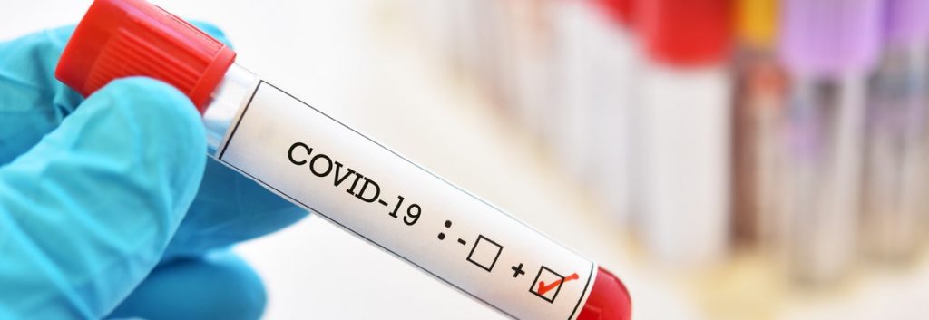 Mit dem „Repurposing“-Prinzip wollen Arzneimittelforscher Medikamente gegen das neuartige Coronavirus entwickeln. Foto: ©iStock.com/jarun011