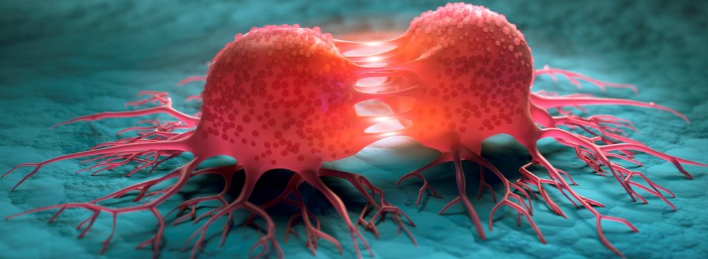 Wie schnell haben Krebspatienten Zugang zu innovativen Therapien? Hier gibt es in Europa große Unterschiede. Foto: ©iStock.com/peterschreiber.media