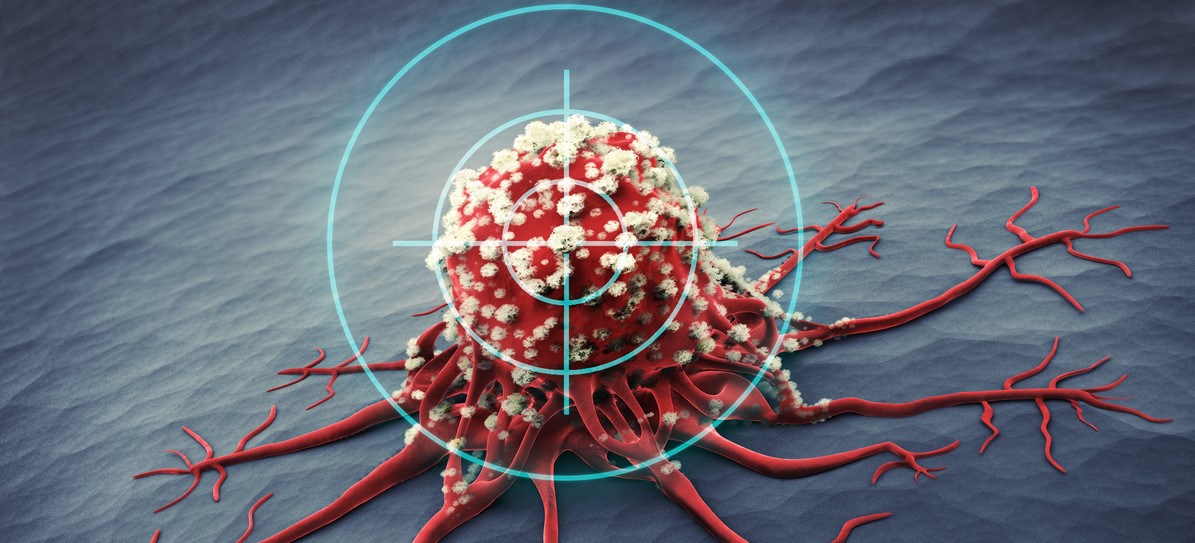 Die Geschichte der Krebsmedizin ist die Geschichte eines immer tieferen Verständnisses der Erkrankung. Darüber spricht Dr. Niko Andre von AstraZeneca im Podcast „Inside the Client“. Foto: ©iStock.com/peterschreiber.media