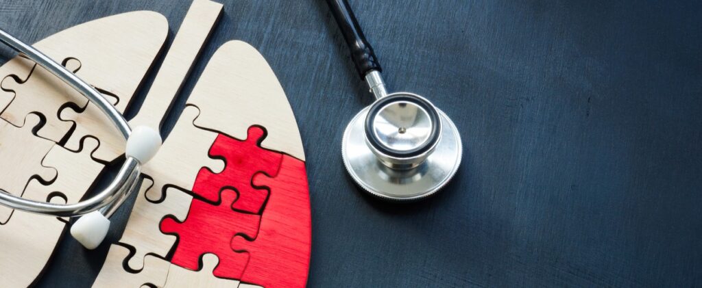 Lungenkrebs ist die häufigste krebsbedingte Todesursache in Europa. Aber: Die Sterblichkeit geht zurück – jetzt auch bei den Frauen. Foto: ©iStock.com/designer491