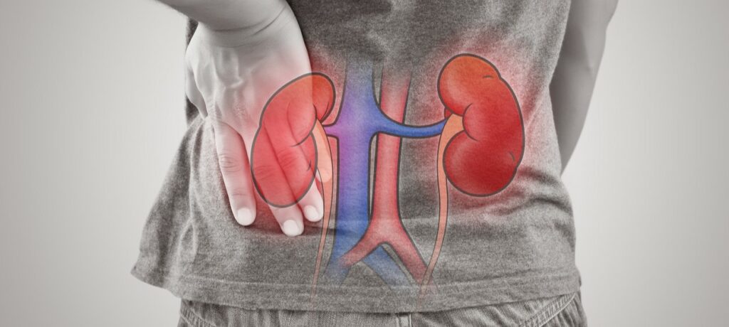 Mehr als 9 Millionen Menschen leiden an der chronischen Nierenkrankheit – die wenigsten wissen davon. Dabei gibt es einfache Tests für eine sichere Diagnose und hervorragende Behandlungsmöglichkeiten. Foto: ©iStock.com/Tharakorn
