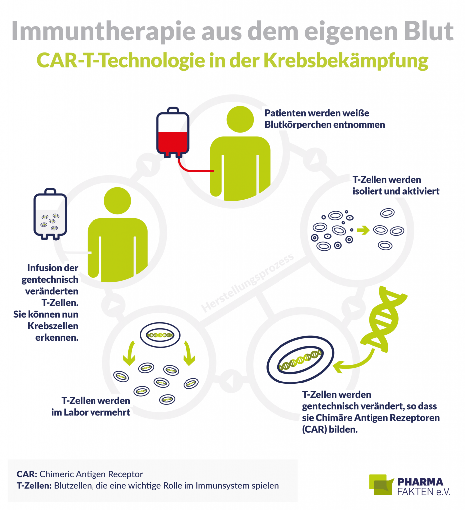 CAR-T-Zelltherapie: Großer Hoffnungsträger im Kampf gegen Krebs.